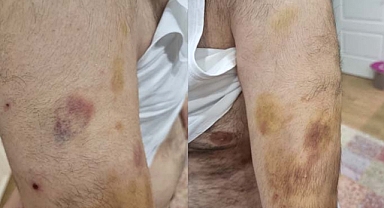 DAYAKÇI ÖĞRETMENE TAHLİYE KARARI